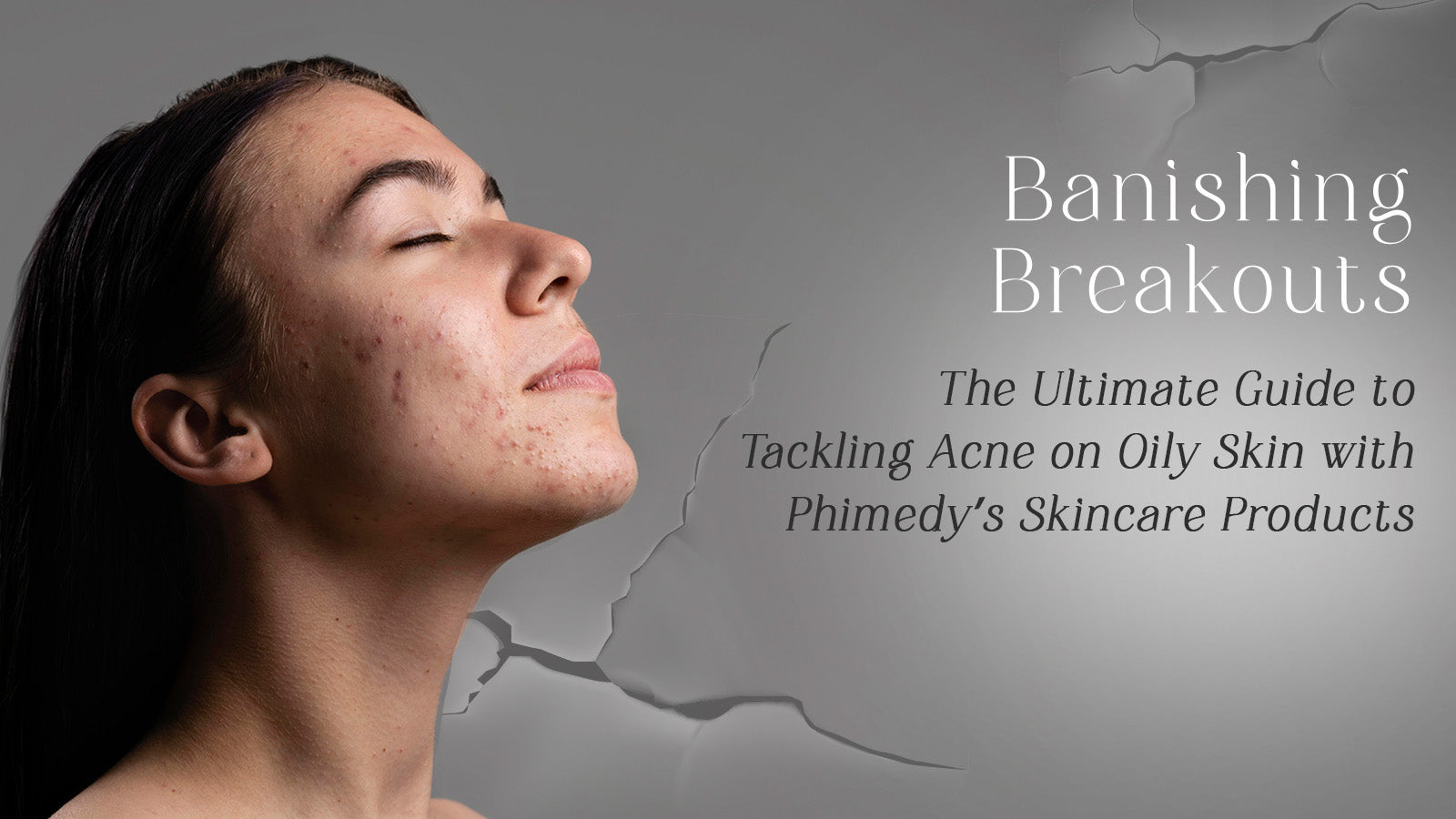 Banishing Breakouts: The Ultimate Guide to Tackling Acne on Oily Skin with Phimedy’s Skincare Products!