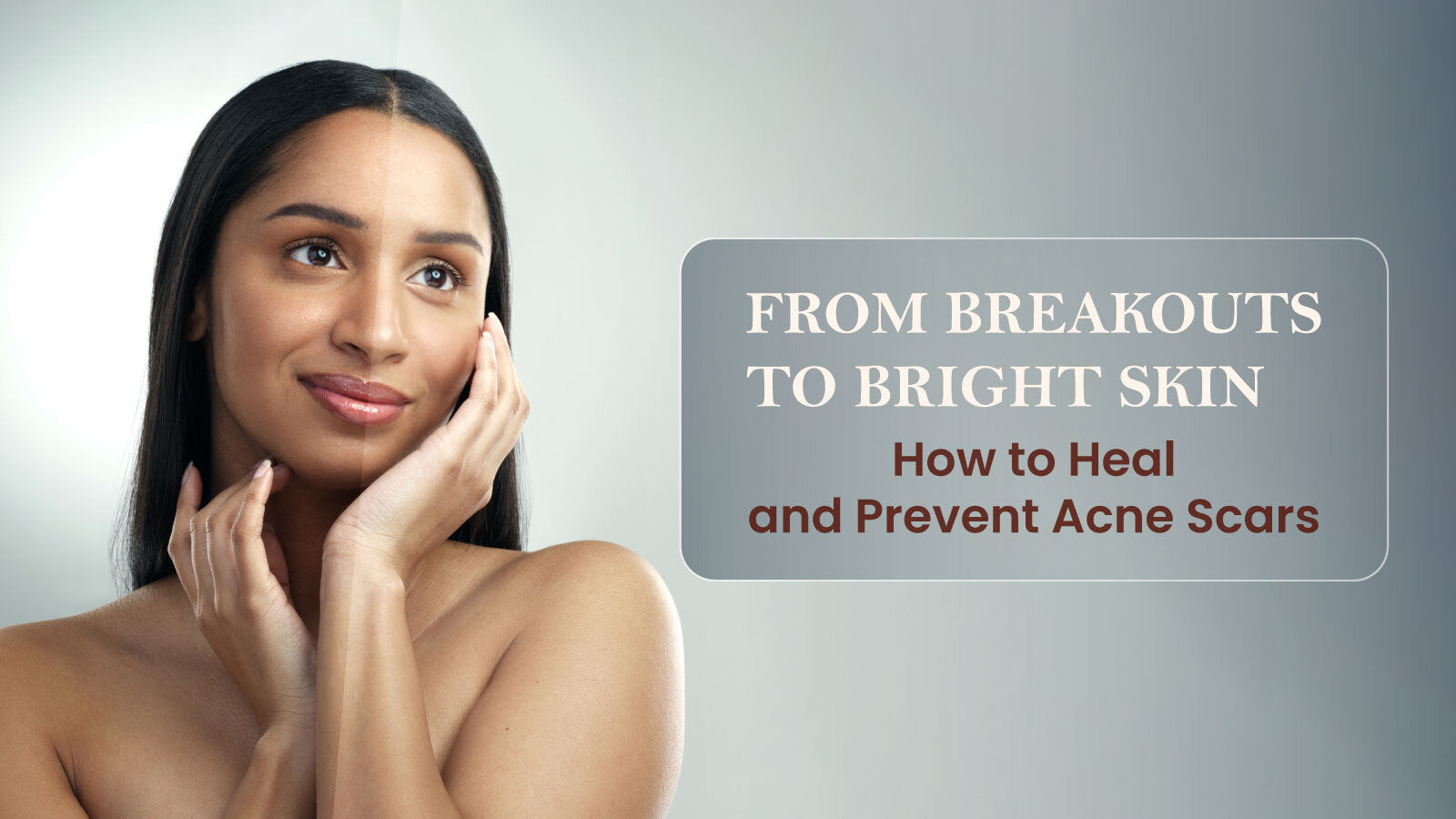 From Breakouts to Bright Skin How to Heal and Prevent Acne Scars
